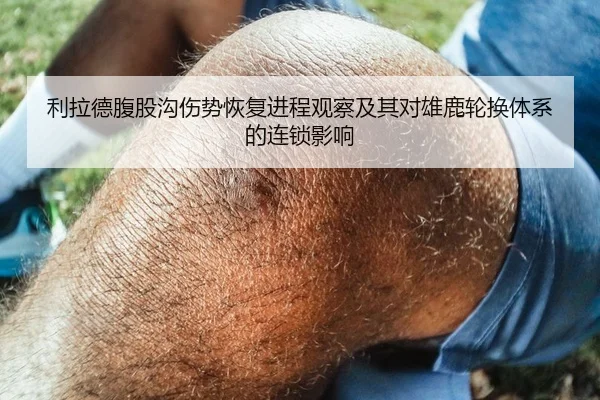 利拉德腹股沟伤势恢复进程观察及其对雄鹿轮换体系的连锁影响